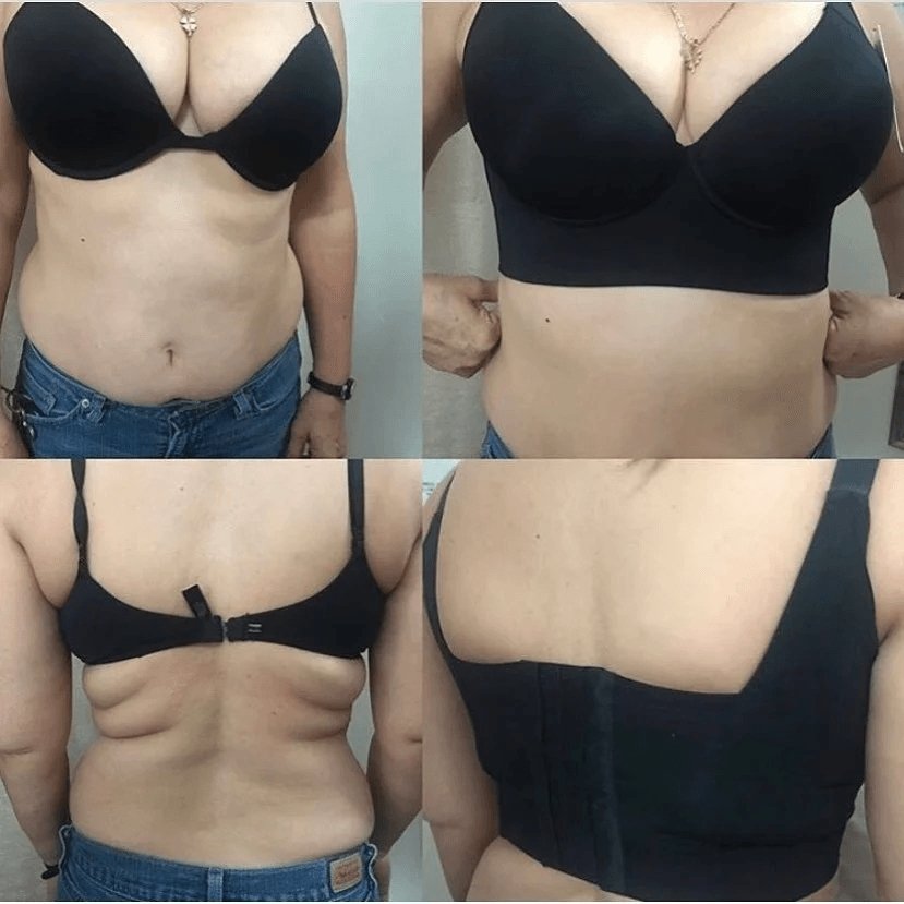 Sutiã Lipo Lift - Sustentação, Modelagem e Conforto